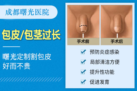 郫县团结哪里可以做包茎手术